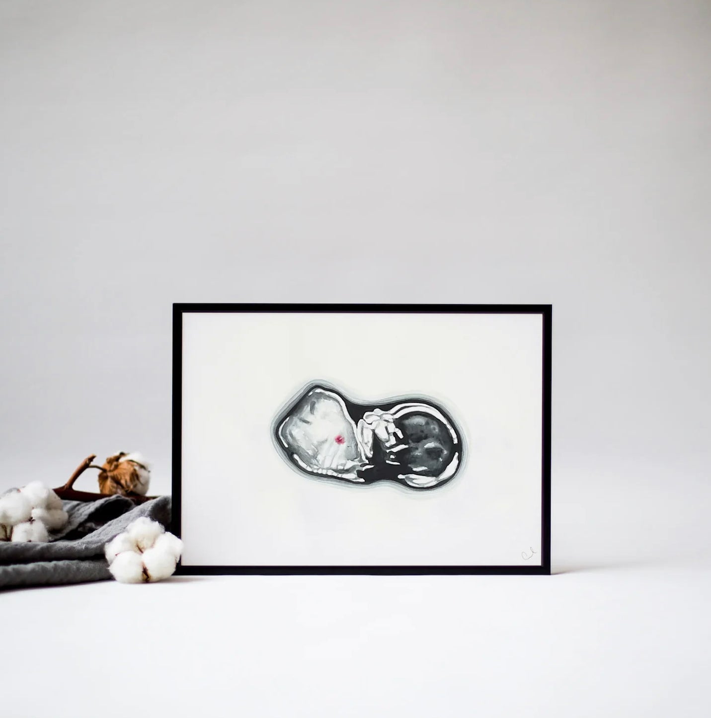 sonogram art from cotton stories, framed